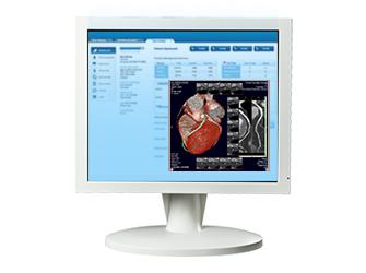 LCD medical touch screen display for radiology 